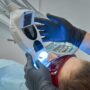 Laserowe wybielanie zębów – na czym polega i czy jest bezpieczne?